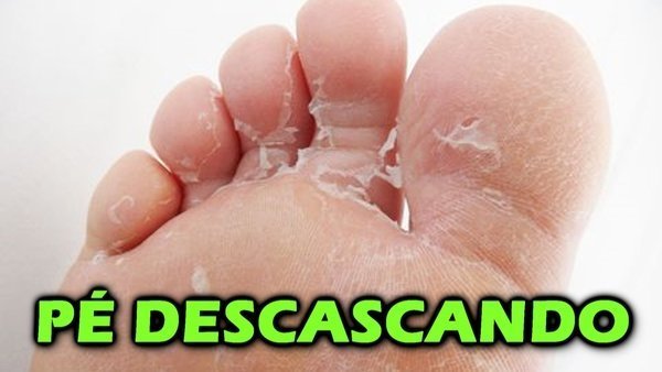 Tem como quebrar o peito do pé?
