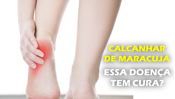 O que é calcanhar de maracujá? Calcanhar de maracujá fotos, calcanhar de maracujá vídeo