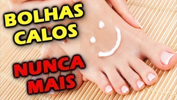 Como evitar bolhas e calos? Cuidado para os pés! - Buscar Saúde