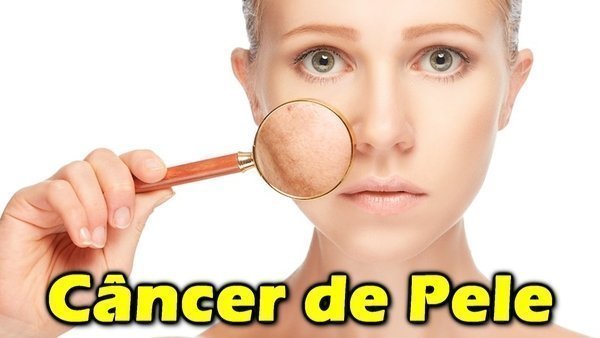 Quais os sintomas do câncer de pele?