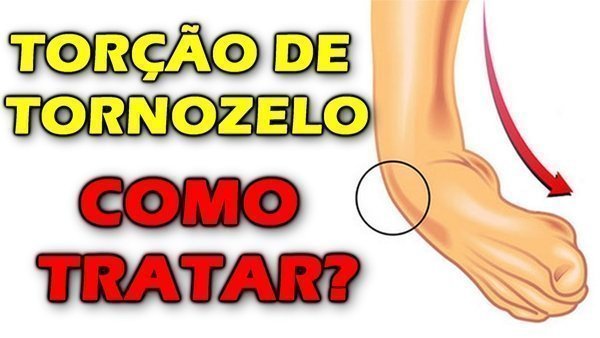 O que é torção de tornozelo?