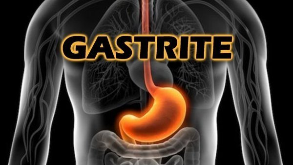 Gastrite, qual o tratamento?