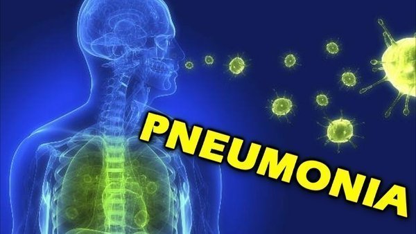 Quais os tipos de pneumonia?