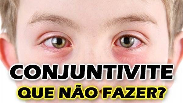 Sintomas de conjuntivite