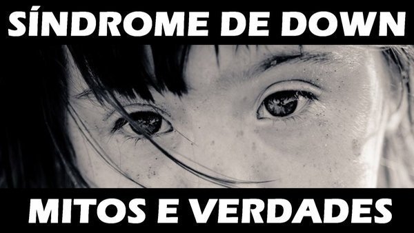 O que é Síndrome de Down?