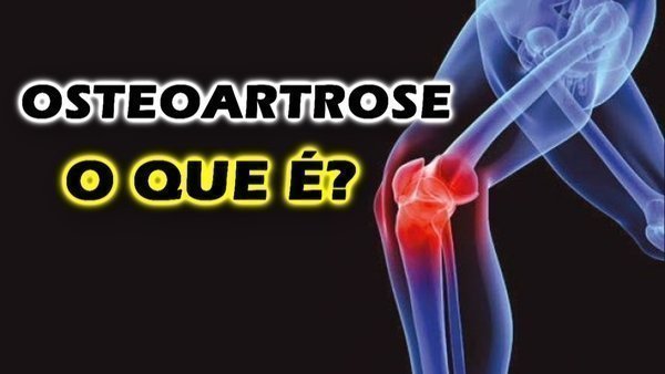 Quais as causas da artrose?