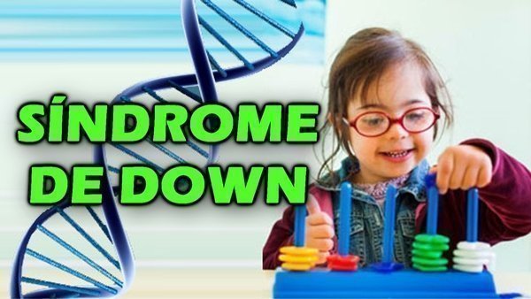 O que é Síndrome de down?