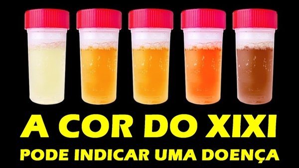 Cor da urina, o que significa?