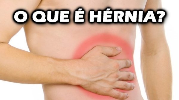 O que é hérnia? Quais os sintomas da hérnia?