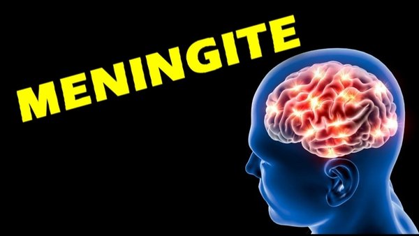 Meningite viral e meningite bacteriana, quais as diferenças?