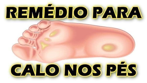 Remédio para calos no pés