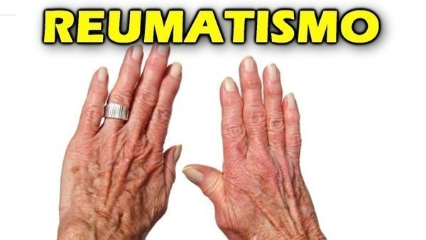 O que é reumatismo? Quais os tratamentos?
