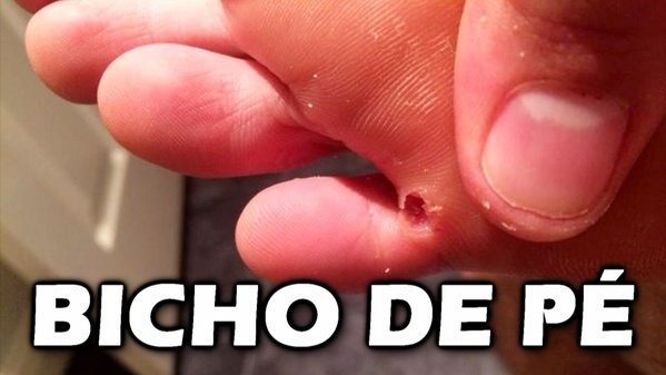 O que é bicho de pé?
