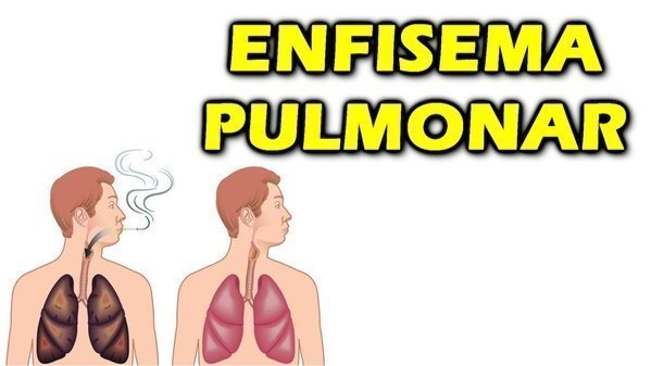 O que é enfisema pulmonar?