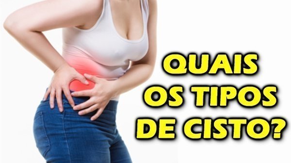 O que é cisto no ovário e cisto de baker?