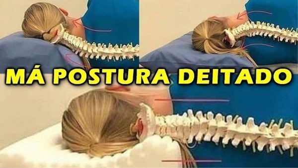 Remédio para dor nas costas, remédio para dor na coluna!