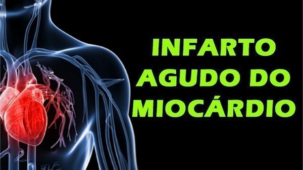 O que é infarto do miocárdio?