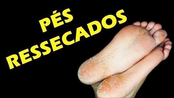Pé descascando, o que pode ser?