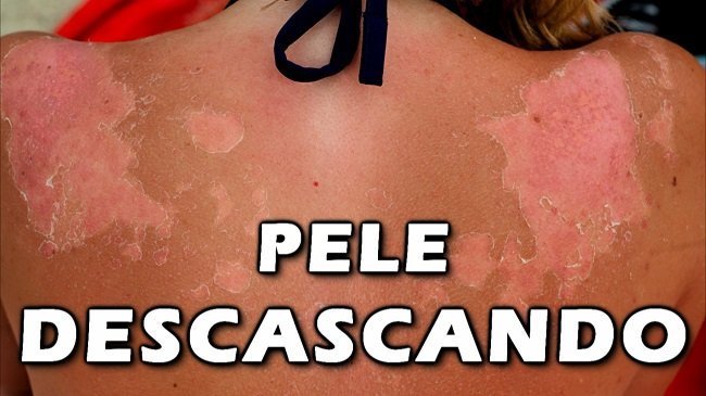 Pé descascando, pele descascando!