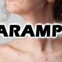 O que é Sarampo? Causas, sintomas e tratamento!