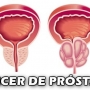 Câncer de próstata, quando fazer o exame de próstata?