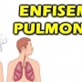 Enfisema Pulmonar, o que é? Causas, sintomas e tratamento!