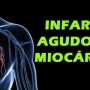 Infarto agudo do Miocárdio! Causas e sintomas