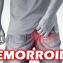 Hemorroida, o que é? Causas, sintomas e tratamentos!